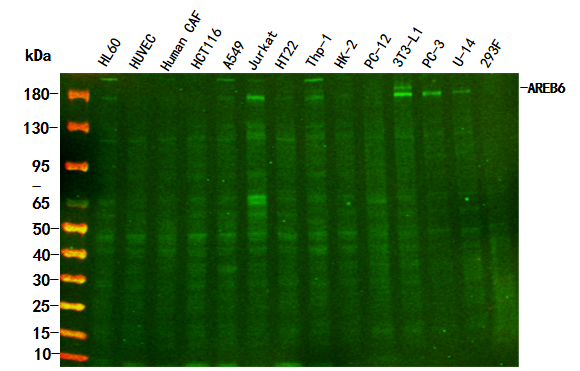 AREB6 Rabbit Monoclonal antibody