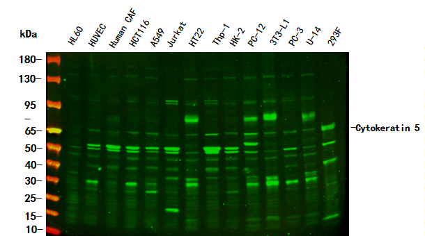 Cytokeratin 5 Rabbit Monoclonal Antibody