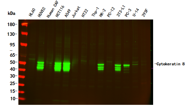 Cytokeratin 8 Rabbit Monoclonal Antibody