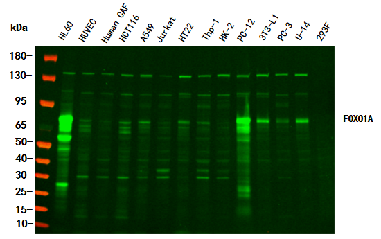 FoxO1 Rabbit Monoclonal Antibody