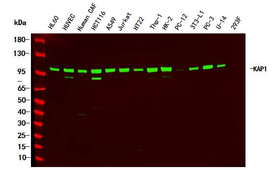 KAP-1 Rabbit Monoclonal Antibody