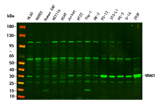 VDAC1 Rabbit Monoclonal Antibody
