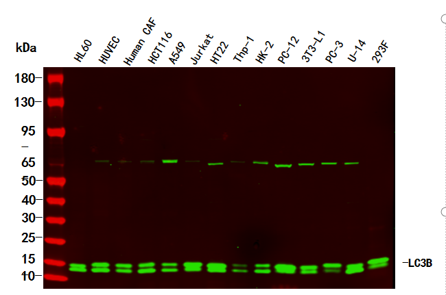 LC3B Rabbit Monoclonal Antibody